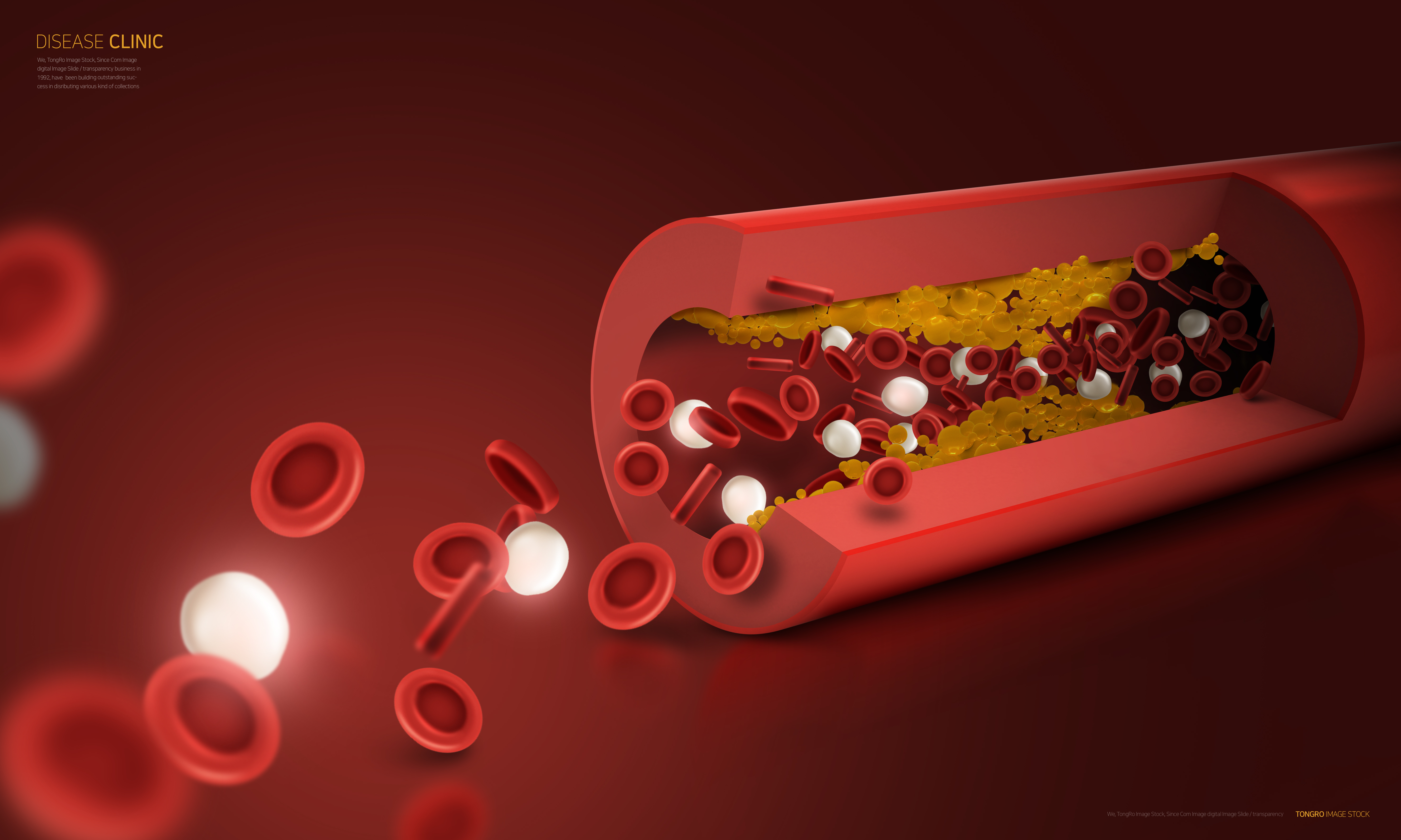 '암', 지난해에만 8만 2천 명 목숨 앗아갔다
