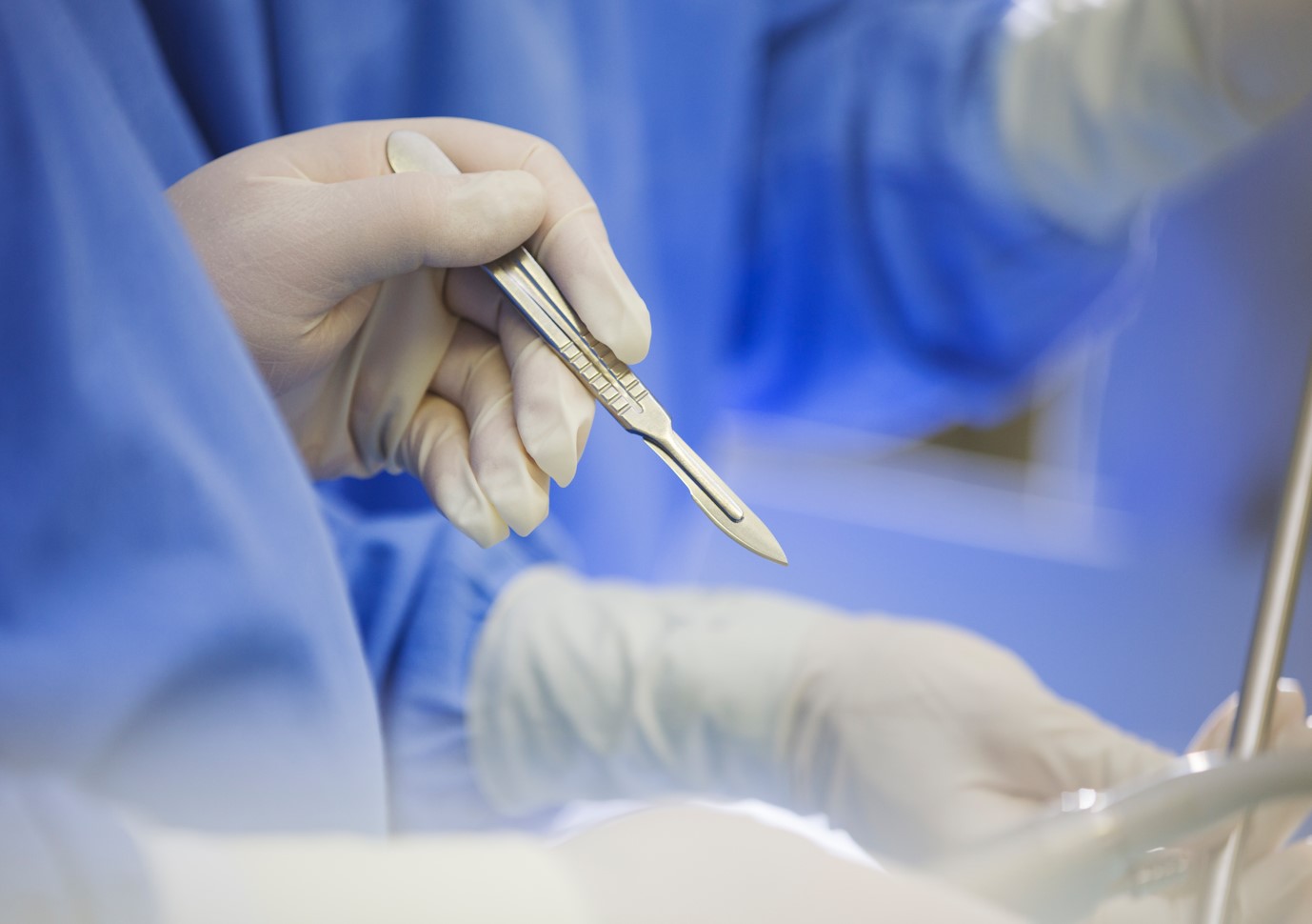 [폴앤톡] 수술실 CCTV 의무화에 ‘헌법소원’까지… 기본권 침해 논란?