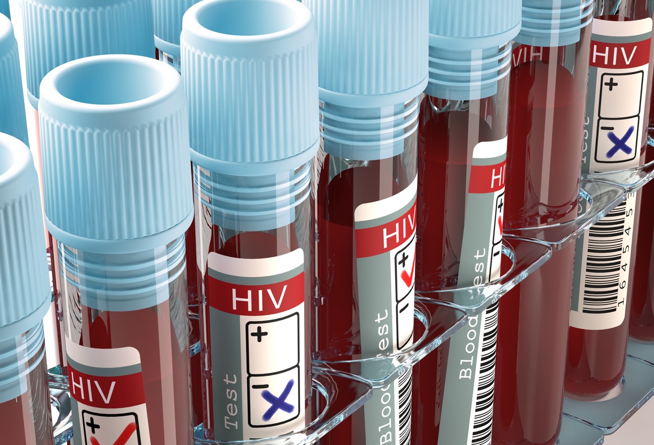 지난해 우리나라 에이즈 신규 환자 1,066명... 91명 늘어